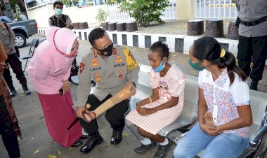 Ibunya-Menangis-Terharu-Saat-Kapolda-NTT-Memberikan-Bantuan-Kaki-Palsu-Kepada-Anaknya-yang-Cacat-sejak-Lahir