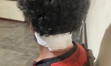 Penganiayaan-di-Desa-Hebing-Seorang-Petani-Luka-Parah-Akibat-Dibacok-:-Polsek-Bola-Lakukan-Tindakan-Cepat